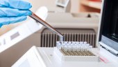 NOVE MERE: U Slovačku samo sa negativnim PCR testom