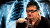 KRATAK DAH I ,,DUGI KOVID: Šta je najčešći simptom korone, a šta je signal da vam je zahvatila pluća?